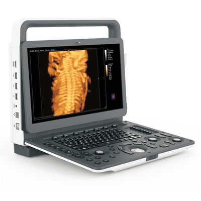 Portable 4D Ultrasound Machine Medical Data Interface Video VGA DICOM3.0 USB Printer Port