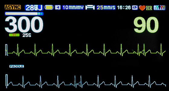 Biphasic Defibrillator Monitor Machine Medical Manual External Synchronous Asynchronous