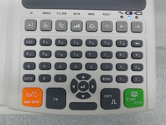 ポータブル診断 12 リード ECG マシン 3 チャンネル 翻訳 診療所と病院